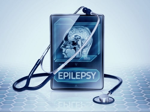 Лечение эпилепсии