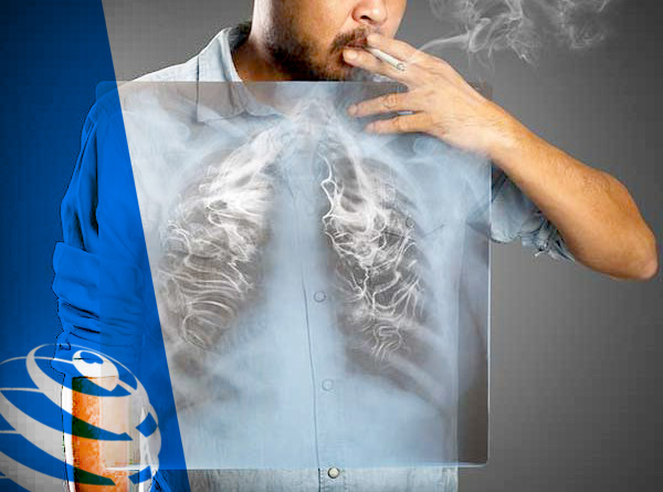 Курение и рак легких